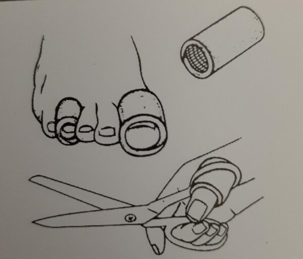 Superlon suojaputki varpaille (koot 15mm, 18mm, 21mm, 25mm, 33mm)) - Image 3